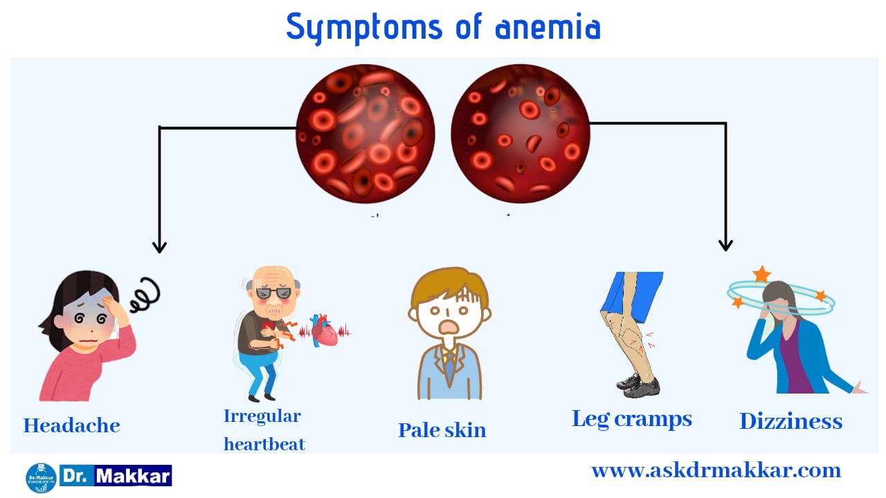 Symptoms of Anemia