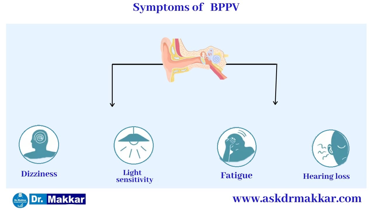 Symptoms of Benign Paroxysmal Positional Vertigo BPPV ||  बिनाइन पैरॉक्सिसमल पोजिशनल वर्टिगो के लक्षण