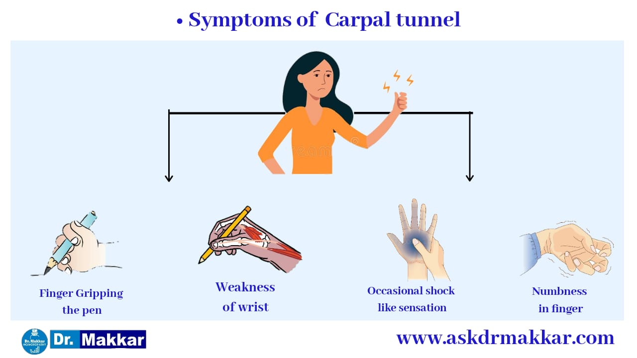 Symptoms of Carpal tunnel syndrome || कार्पल टनल सिंड्रोम के लक्षण