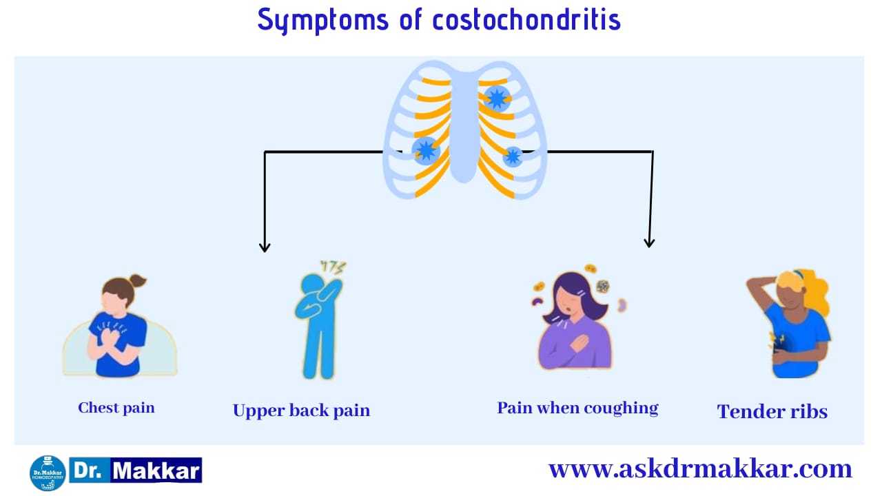 Symptoms of Costochondritis Pain in Ribs || कोस्टोकोंडाइटिस पसली में सूजन के लक्षण