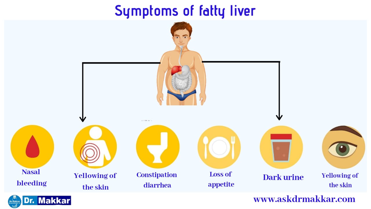 Symptoms of Fatty Liver in detail 