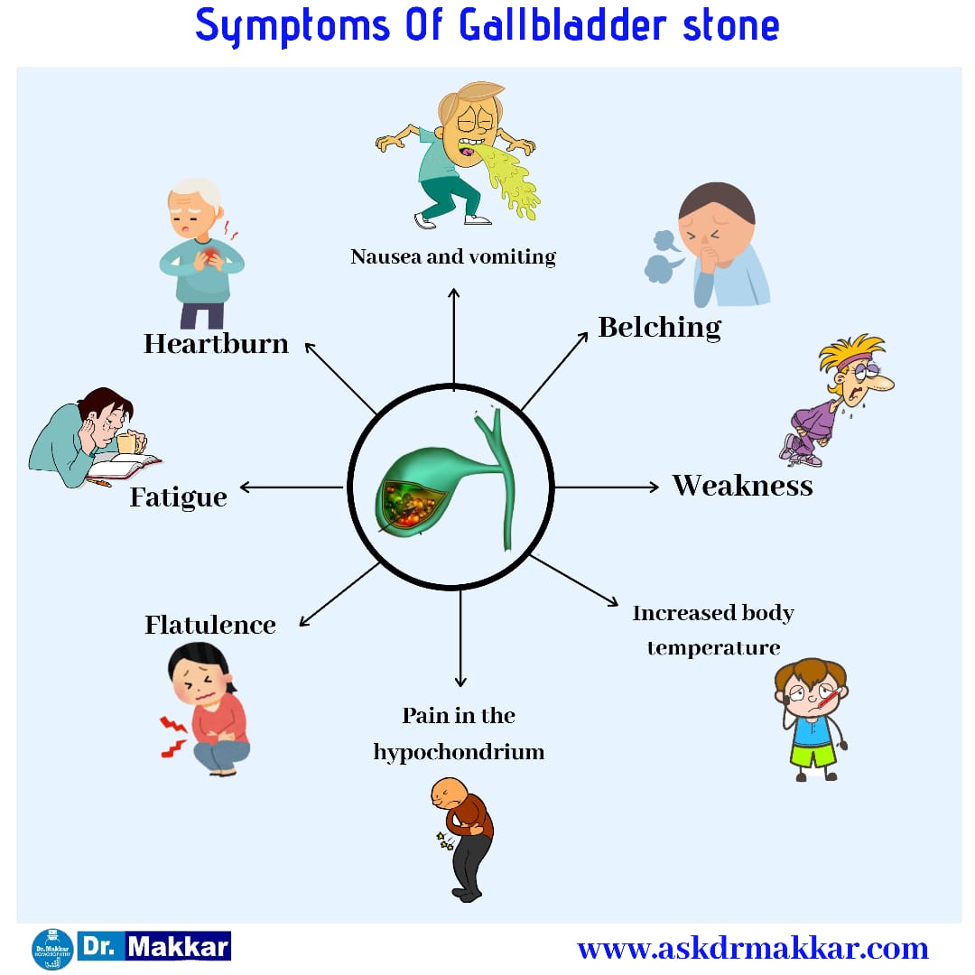 Symptoms of Gallstone Cholelithiasis