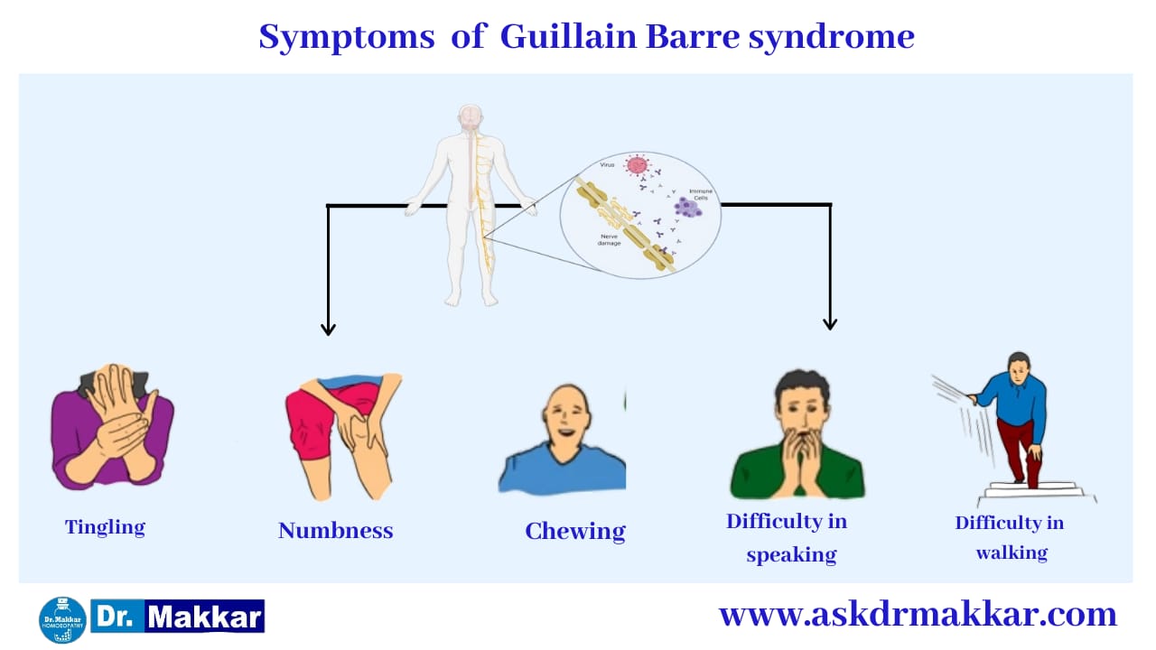 Symptoms of Guillain Barre Syndrome || गियॉन-बार्रे सिंड्रोम नाड़ी के लक्षण