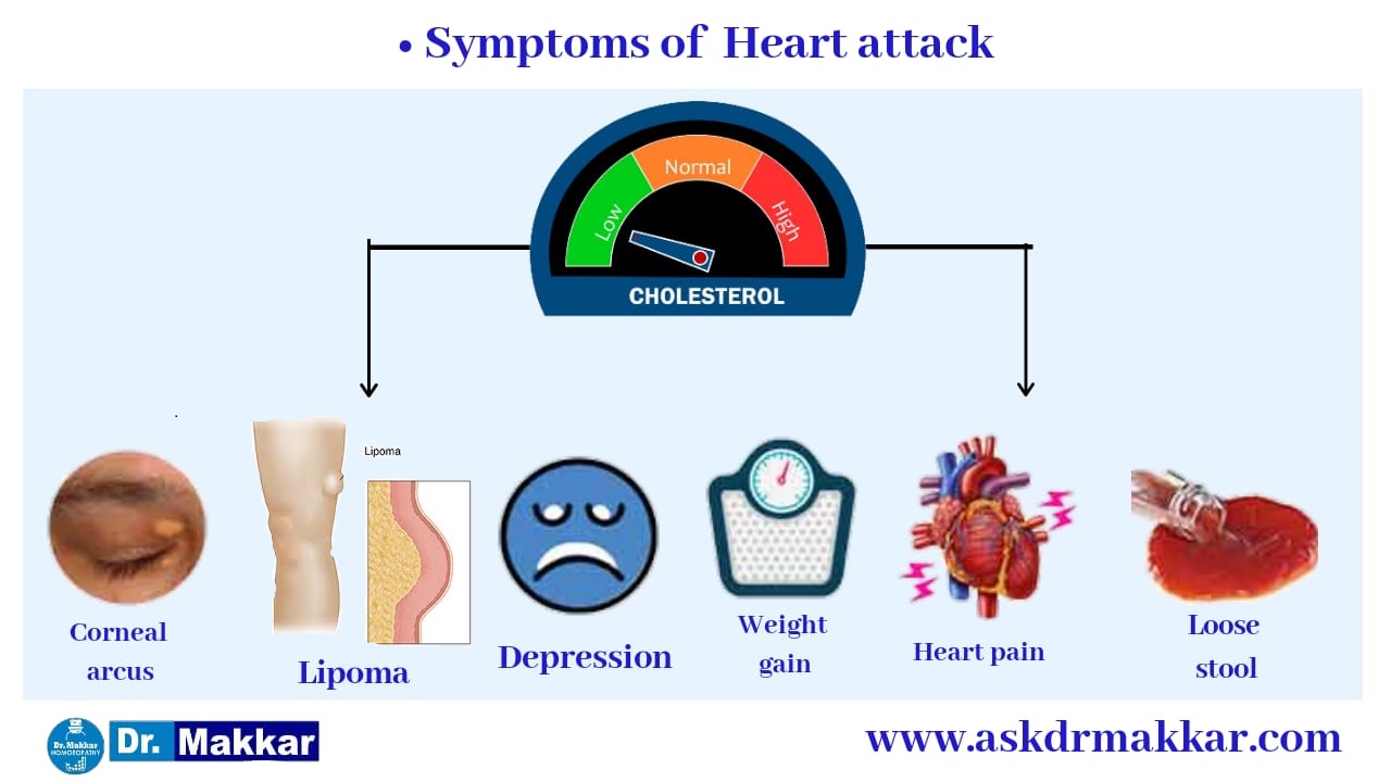 Symptoms of High Cholestrol also called Hyperlipidaemia   हाई कोलेस्ट्रोल या हाइपरलिपिडिमिया  के लक्षण