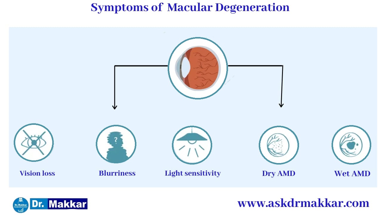 Symptoms of Macular degeneration ARMD || मैक्युलर डीजेनेरेशन के लक्षण