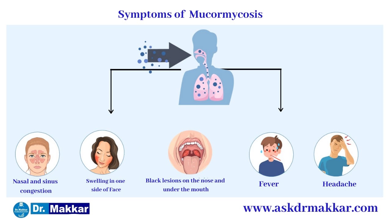 Symptoms of Mucormycosis || Black Fungus || Zygomycosis ||  ब्लैक फंगस के लक्षण