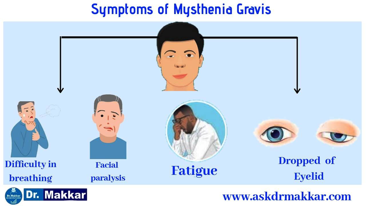 Symptoms of Mysthenia gravis 