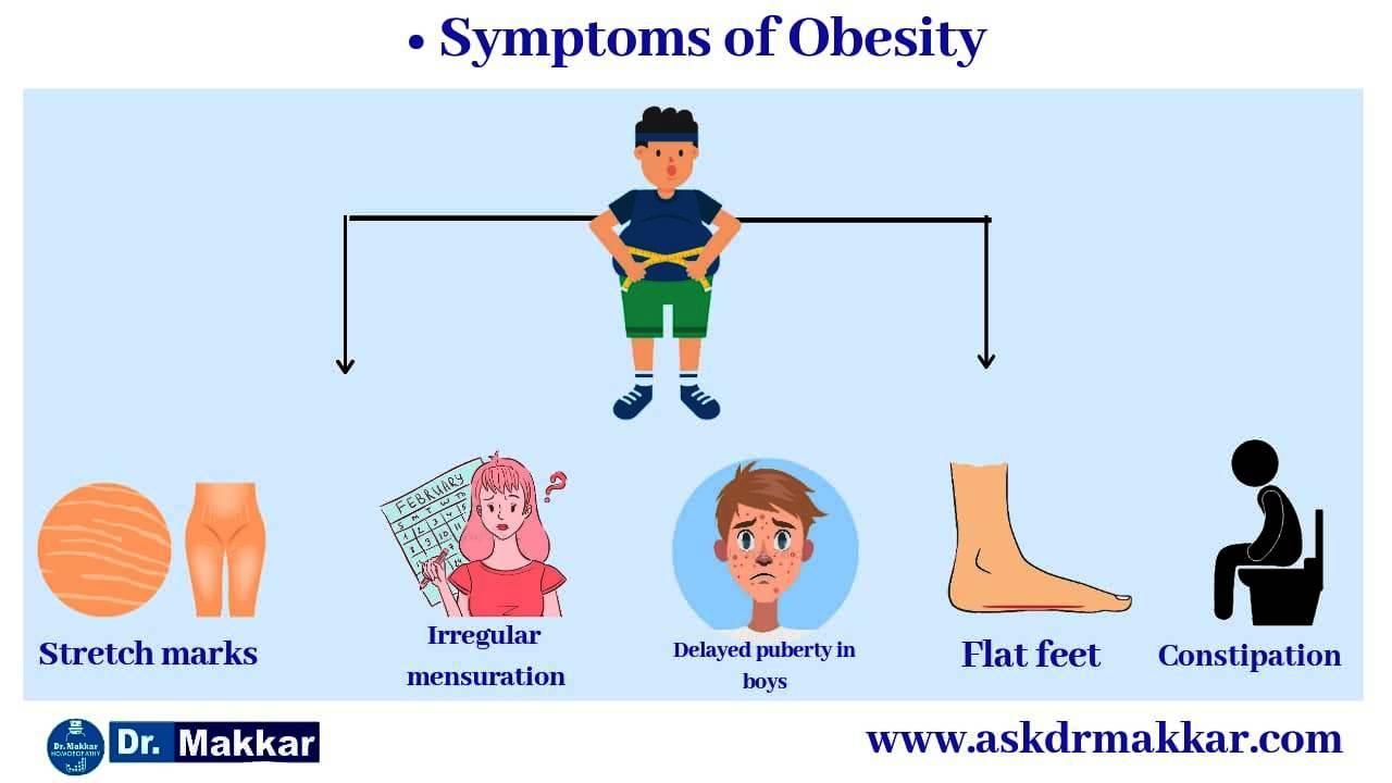 Symptoms of  Obesity weight loss statergy