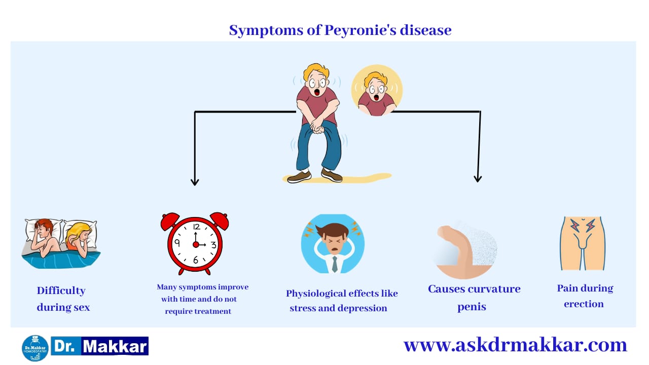 Symptoms of Peyronies disease curved Penis  पेयरोनी डिजीजलिंग का टेढ़ापन मुंडा लिंग रोग के लक्षण