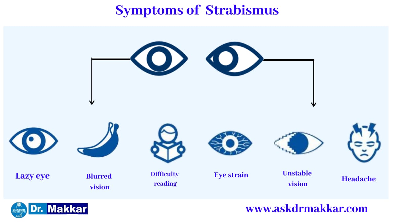 Symptoms of Strabismus Crossed Eye || भेंगापन तिर्यकदृष्टि स्ट्राबिस्मस के लक्षण