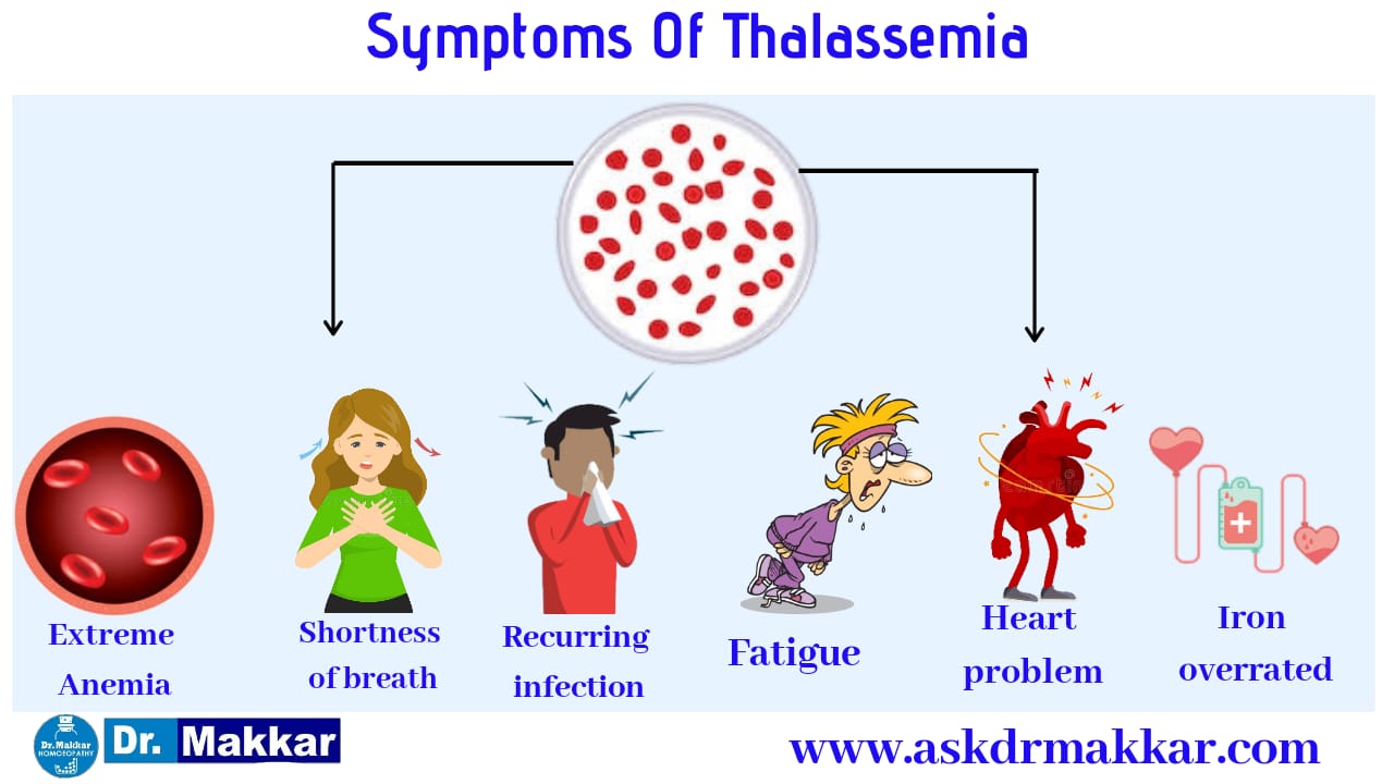 Symptoms of Thallasemia Homeopathic approach