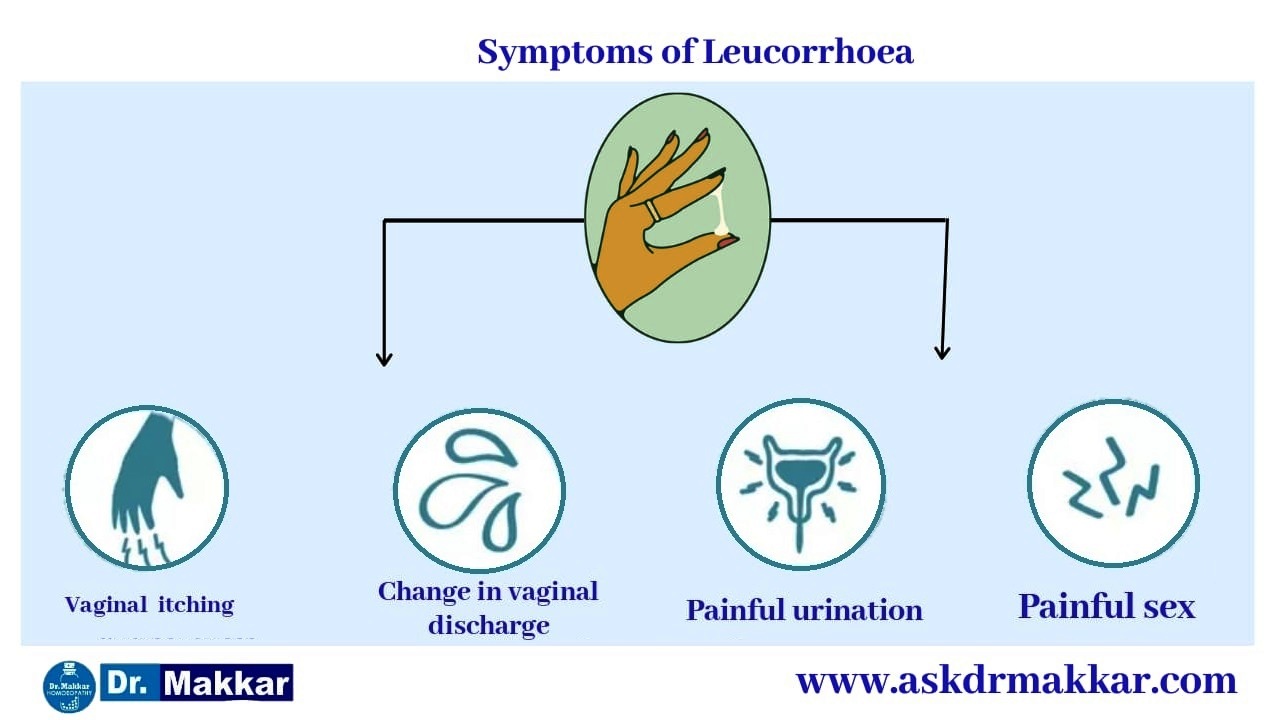 Symptoms of White discharge also called Leucorrhoea || ल्यूकोरिया के सफेद निर्वहन के लक्षण 