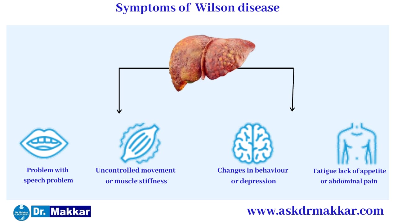 Symptoms of Wilson Disease || विल्सन रोग के लक्षण