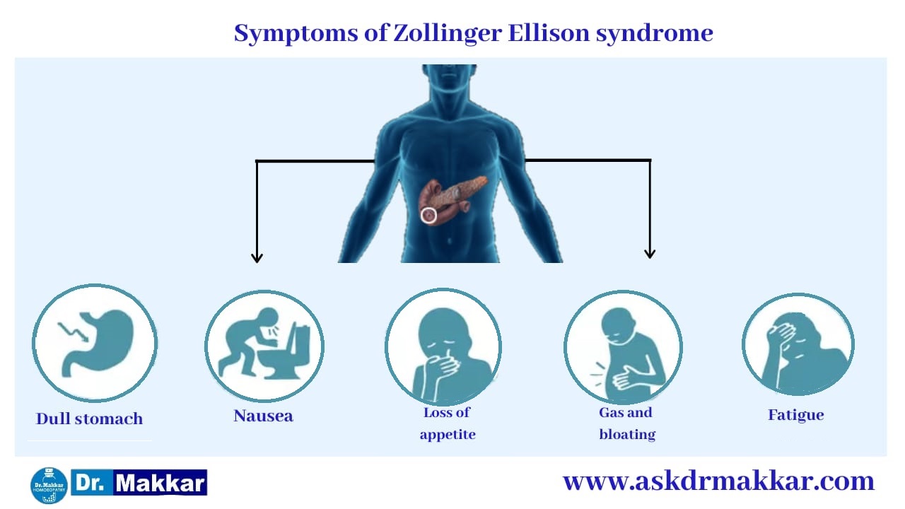 Symptoms of Zollinger-Ellison syndrome || ज़ोलिंगर एलिसन सिंड्रोम के लक्षण