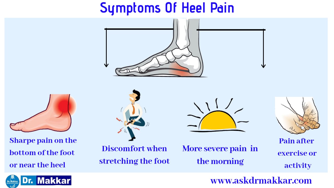 Symptoms of heel pain Calcaneal Spur