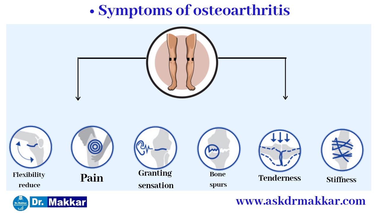 Symptoms of osteoarthritis