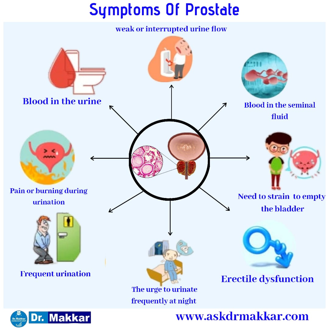 Symptoms of Prostate Enlargement