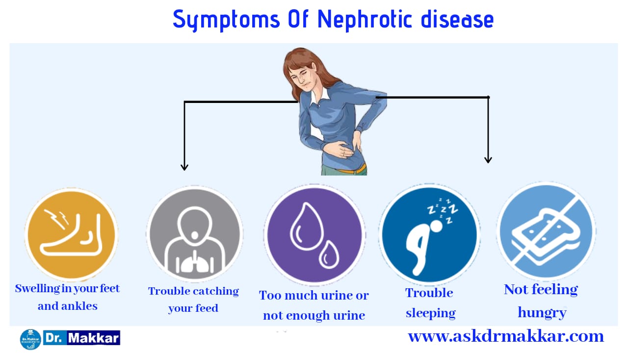 Symtoms of Nephrotic disease