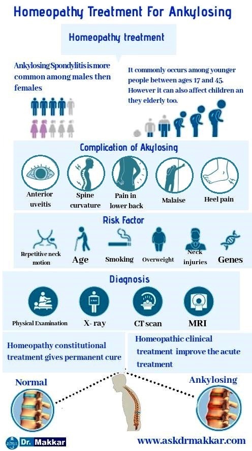 Best Homoeopathic Treatment for Ankylosing Spondolysis permanently cure patient using Homeopathy on Hla b27 gene without sideeffects  || आंकिलोसिंग स्पॉन्डिलाइटिस का सफल इलाज  ||  अस्थिसमेकन होम्‍योपैथिक ट्रीटमेंट