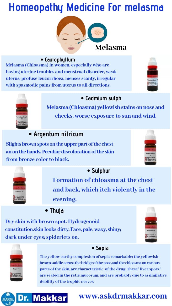 Top Homeopathic medicine for  MALESMA  CHLOASMA remedies