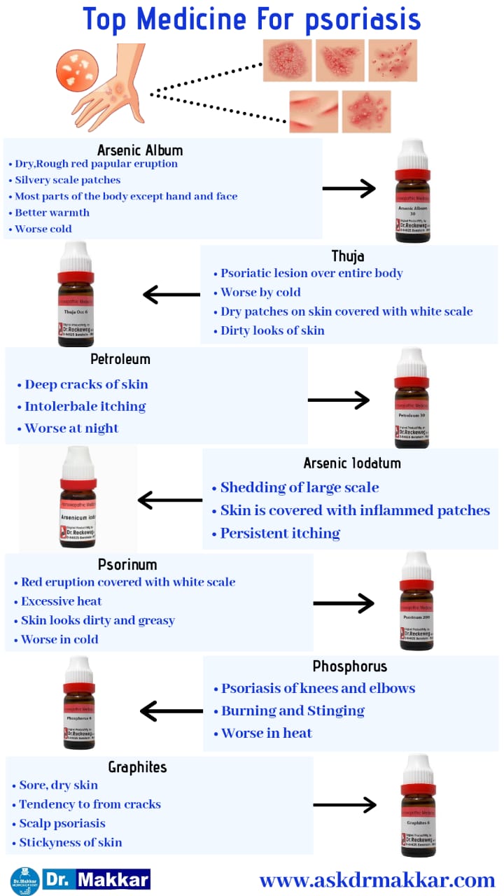 Best Homeopathic Medicines for  Psoriasis top remedies ||  सोरायसिस का होम्योपैथिक दवा ट्रीटमेंट by Dr Makkar