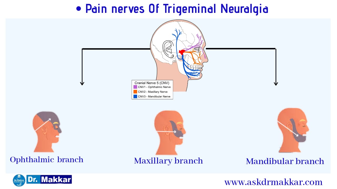 Trigeminal neuralgia nerve root suppling Face