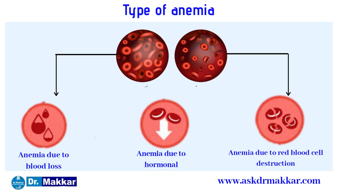 Type of Anemia