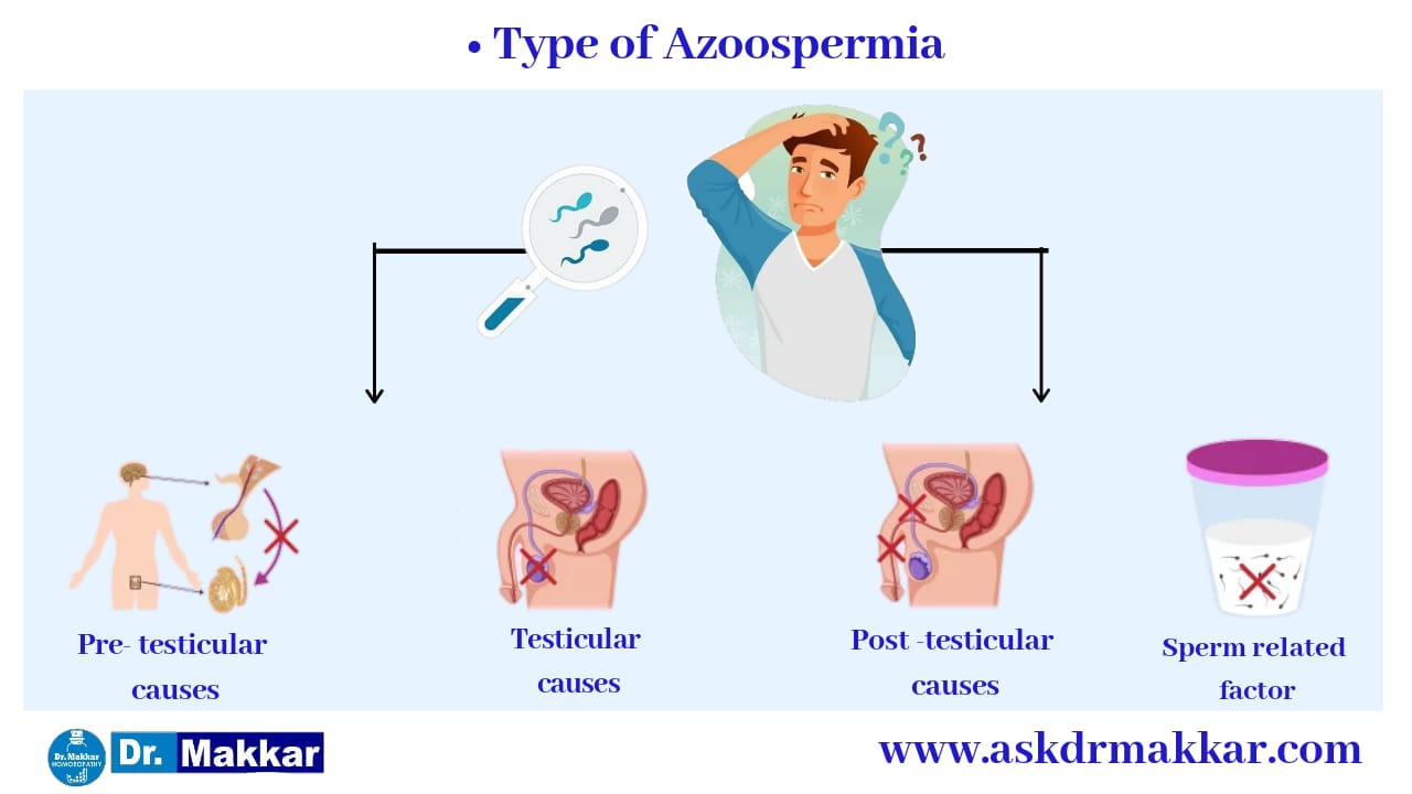 Type of azospermia Reason behind it || निल स्पर्म शुक्राणुहीनता एज़ोस्पर्मिया के प्रकार