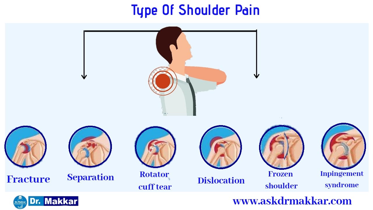 Shoulder Diagnosis Chart