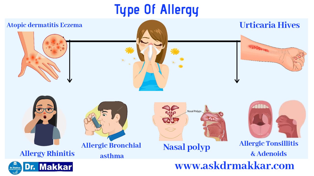 Types of allergy in body