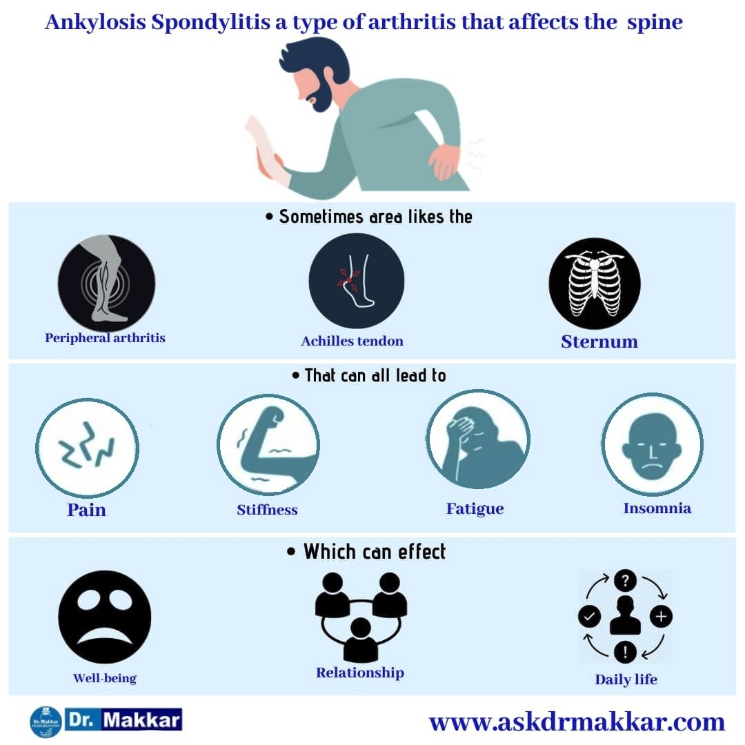 What are the problems other than joint pain that are seen in ankylosing spondylitis?