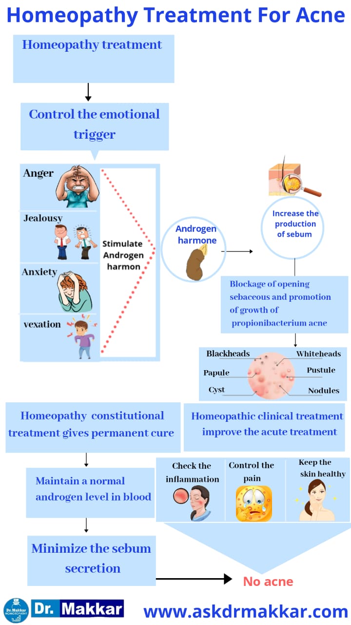 Acne Homeopathic Treatment approach in scientific manner Best Homeopathic Treatment for different types of Acne || विभिन्न प्रकार के मुँहासे के लिए सर्वश्रेष्ठ होम्योपैथिक उपचार  के साथ से होम्योपैथिक ट्रीटमेंट