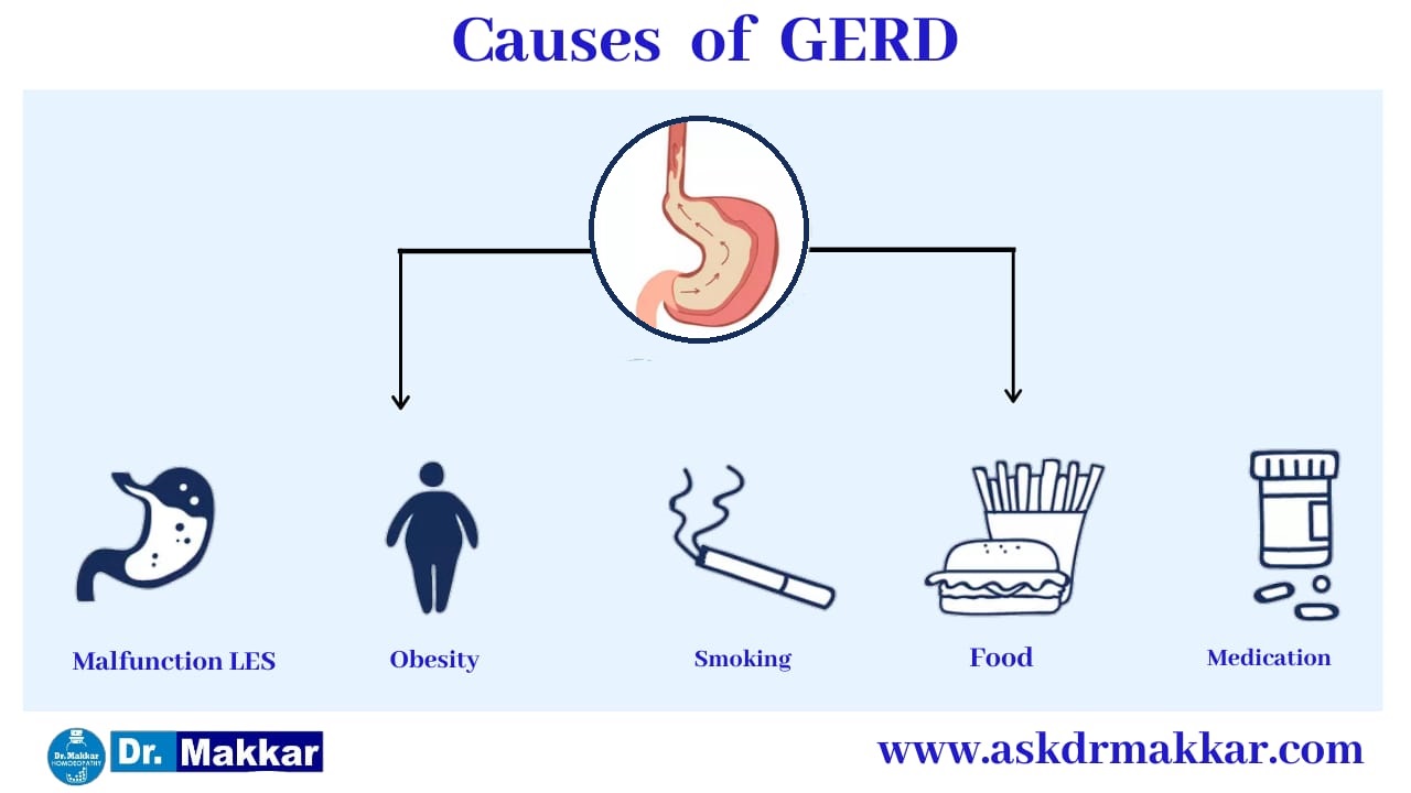 causes of Gerd Gastrooesophageal Reflux Disease ||  गर्ड गैस्ट्रोसोफेजियल रिफ्लक्स बीमारी के कारण