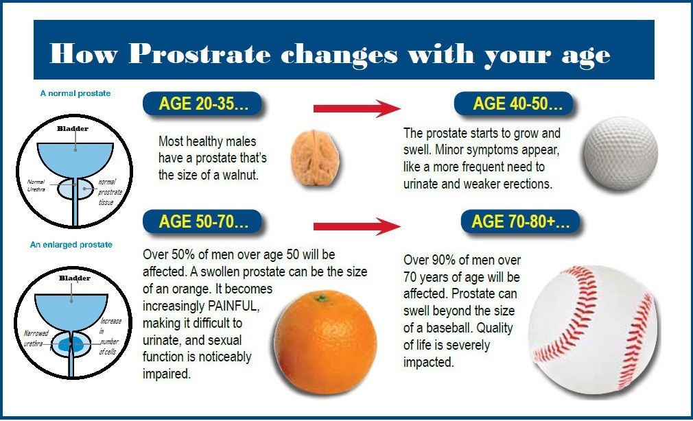 How Prostrate changes acc to your age