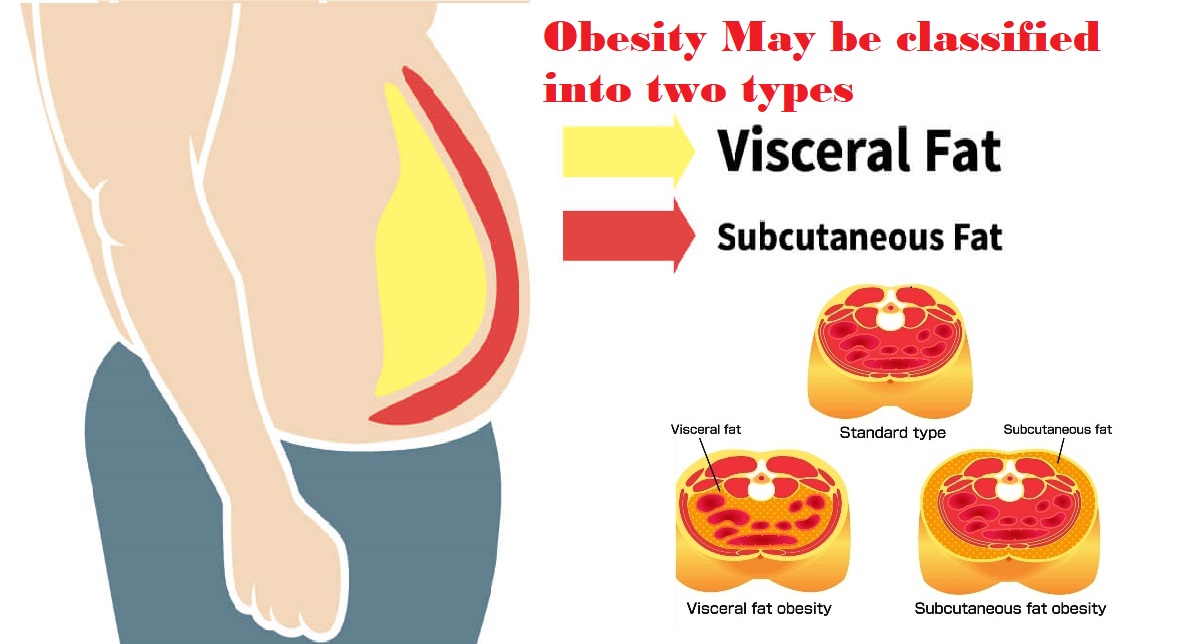 type-of-obesity-visceral vs subcutaneous fat