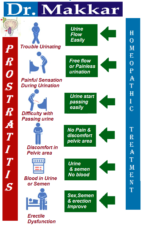 Prostrate Benign Prostatic Hyperplasia Hypertrophy. Homeopathic Treatment