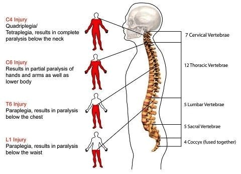 spinal injury lead to multiple level pain 