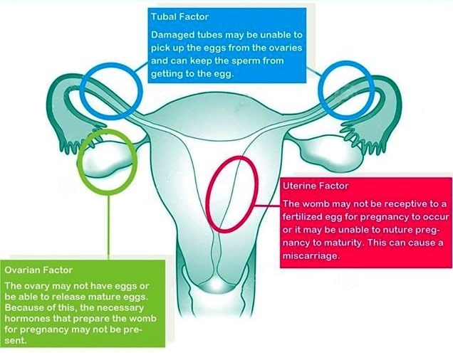 Female infertility Reasons