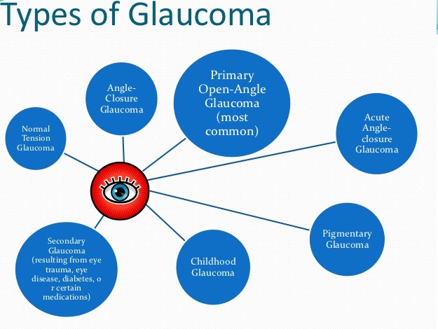 types of glaucoma