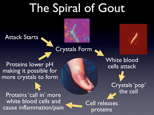 Spiral of gout effecting body