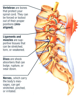 Image result for low back pain showing disk and nerves