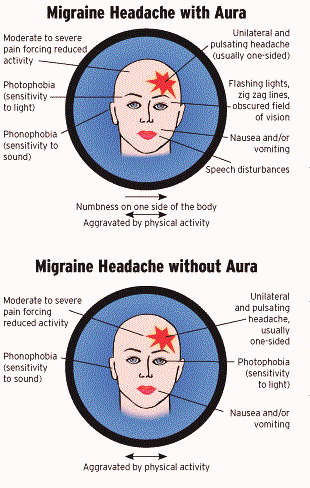 Migaine with or without aura