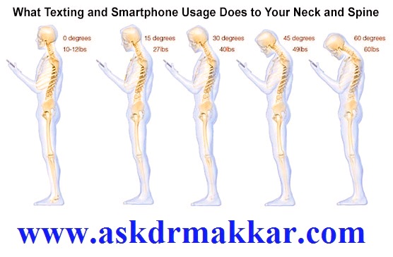 Mobile connection to cervical pain in Cervical spondylosis called as Text neck these days || सर्वाइकल स्पोंडिलोसिस में सर्वाइकल दर्द का मोबाइल कनेक्शन जिसे इन दिनों टेक्स्ट नेक कहा जाता है