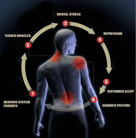 Ankylosing spondolysis pain cycle lead to sleep loss 