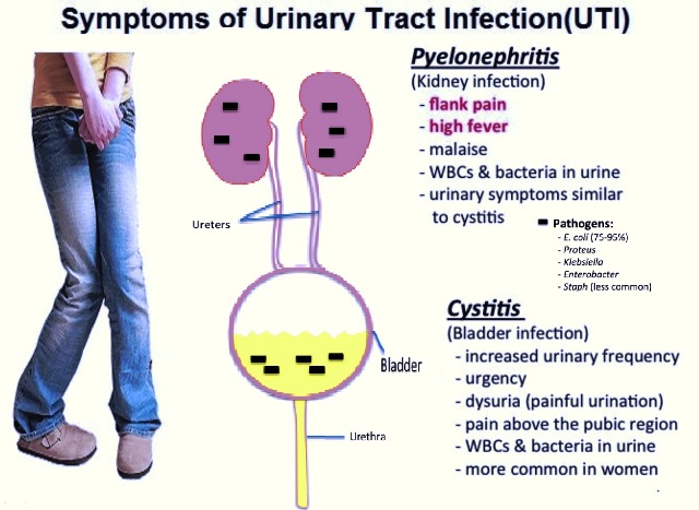 Symptom of UTI