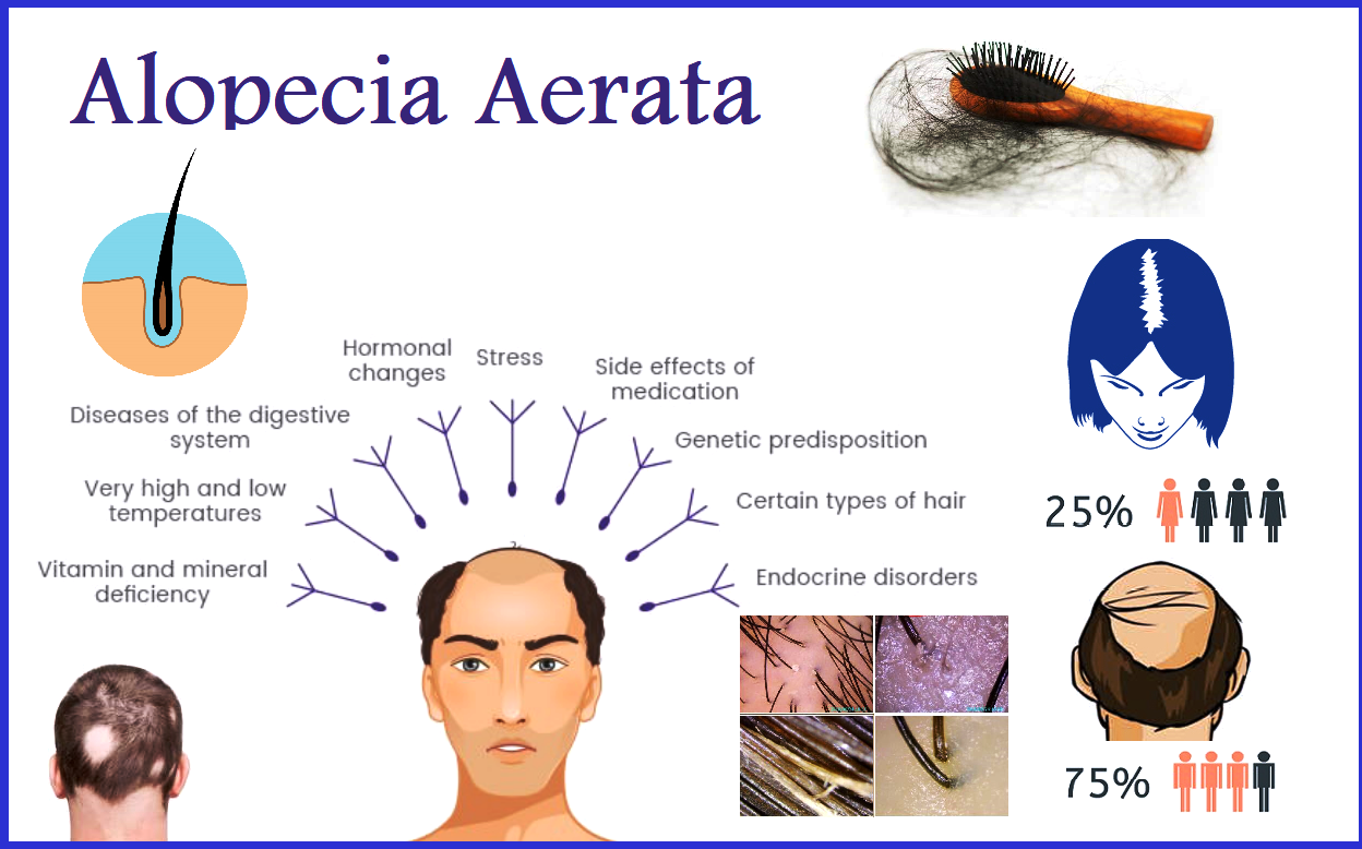 Alopecia Homeopathic treatment BEST HOMEOPATHIC MEDICINES for Baldness