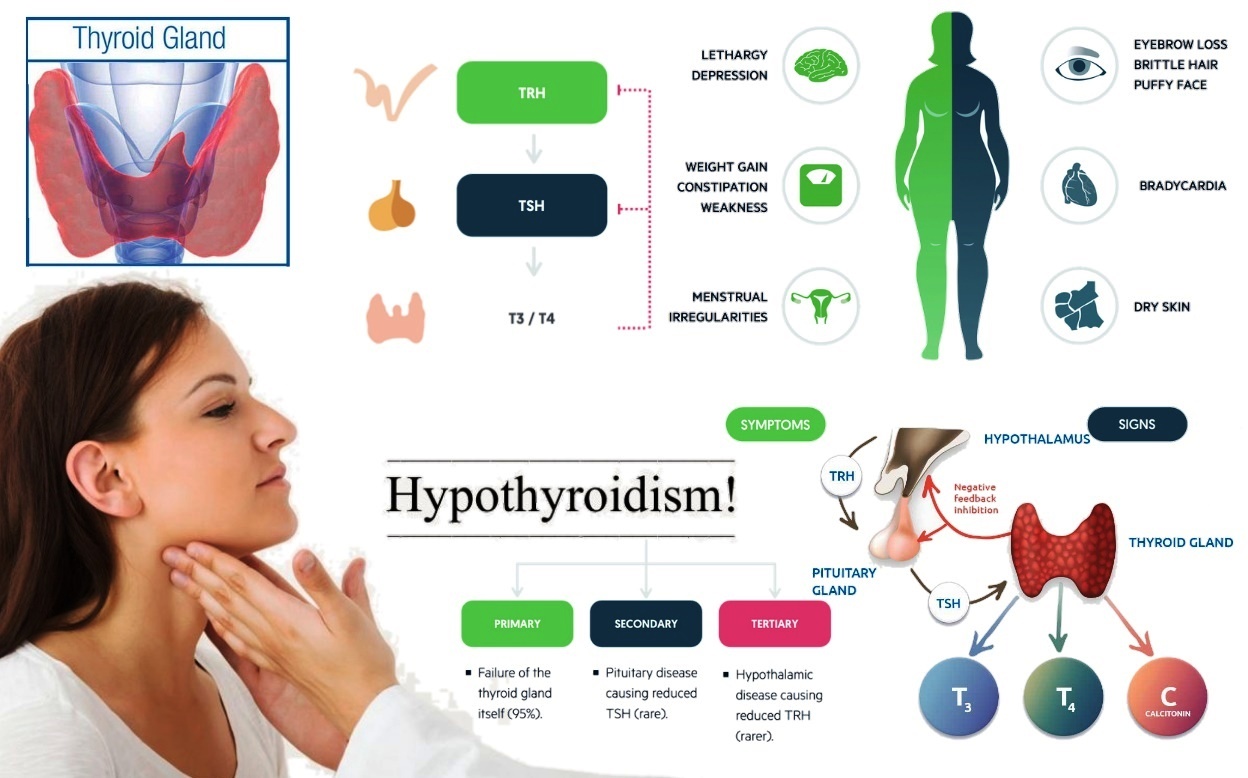 Hypothyroid Homeopathic Treatment Harmonal Disorder Due To Underactive